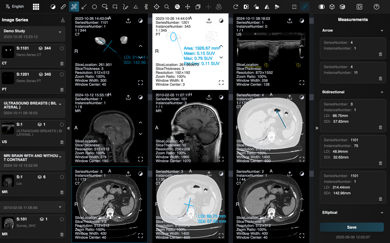 Dicom Browser Mockup