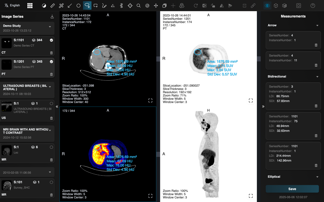 Multi-Modal Fusion