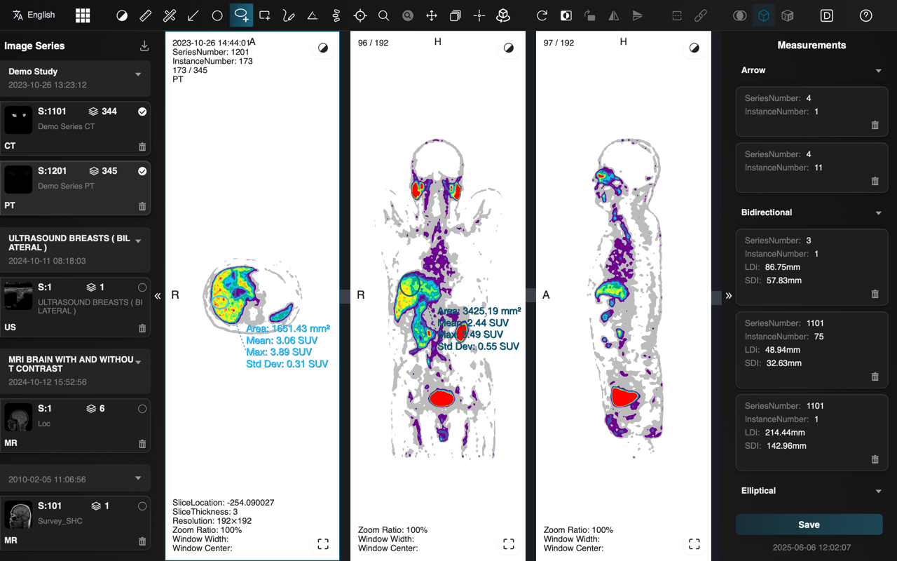Multi-Planar Reconstruction